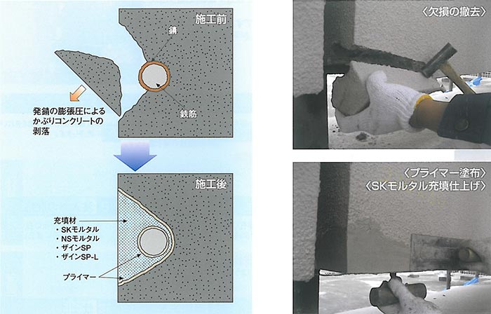 欠損・断面復旧